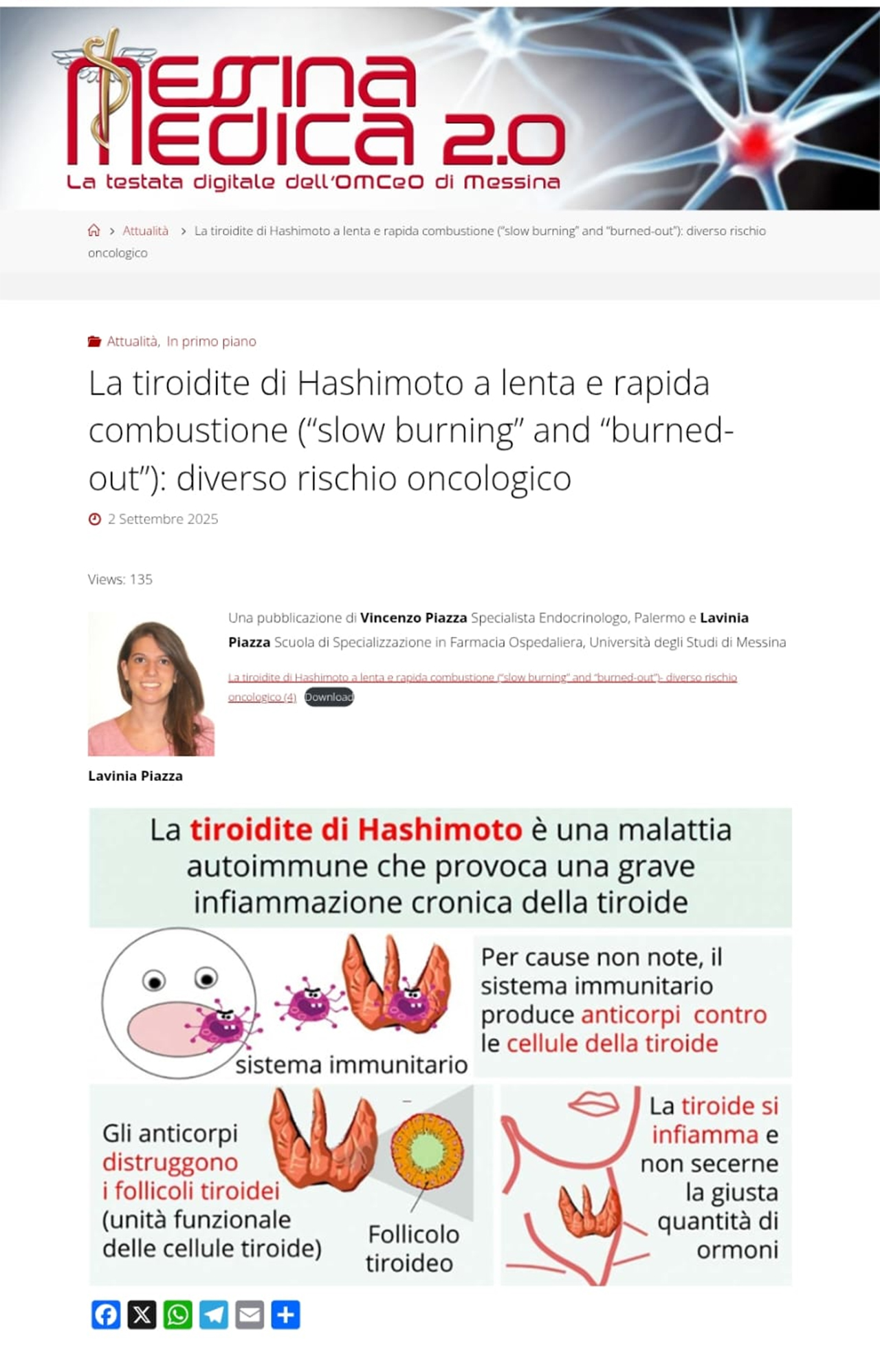 Articolo Dr. Piazza - La Tiroide di Hashimoto